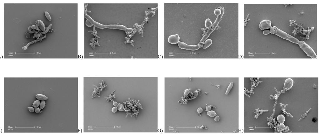 Fig. 1. SEM of C. albicans auto-aggregation (A & E), inter-kingdom interaction with A. naeslundii (B & F), S. mutans (C & G) and both bacteria (D & H). C. albicans was grown as hyphae form (A, B, C & D) and yeast form (E, F, G & H). Magnification is as shown on each image (6500x and 10000x).