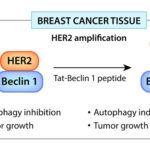 保持清洁可抑制HER2+乳腺肿瘤生长