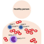 真性红细胞增多症患者的一种新的免疫特征:疾病进展的调节剂