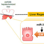 在肝脏再生过程中，MicroRNAs控制着肝细胞的细胞转化。先进的