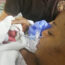 Cuddling of babies born extremely preterm before admission to the Neonatal Intensive Care Unit