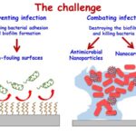 《超能。Nanomaterials as Promising Alternative in the Infection Treatment.