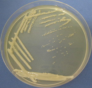 Cryptococcus laurentii