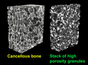 Fig. 1. 3D microtomographic analysis of cancellous bone (left) and a stack of β-TCP granules with a high porosity