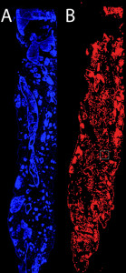 Fig. 2. Fluorescence microscopy images of the infected humanized liver. A) Repopulation of the scaffold with human liver cells. The blue fluorescent dye labels the cell nuclei. B) The red fluorescence shows the production of the reporter in cells that were infected by the viruses.