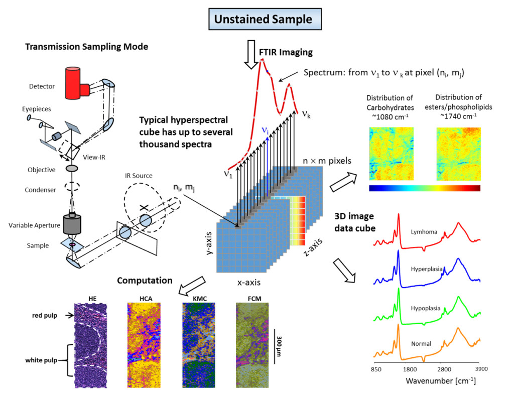 Schematic illustration of a model of hyperspectral images and the morphological integrity after IR microscopic imaging measurements. A single acquisition of an unstained sample records thousands of images across numerous wavelengths, resulting in an image stack forming a three-dimensional (3D) image data cube. The challenges to analyze MIR microscopic imaging data are that: (a) the obtained image data cube may be viewed as spatially located spectra, with the processing tools of classical spectroscopy being applied to single spectra; (b) the data may be viewed as images, with image-processing tools being used to extract higher-quality spatial information. Thus the combination of MIR microscopic imaging, signal and image processing and histomorphological investigations makes MIR microscopic imaging a multidisciplinary discipline.