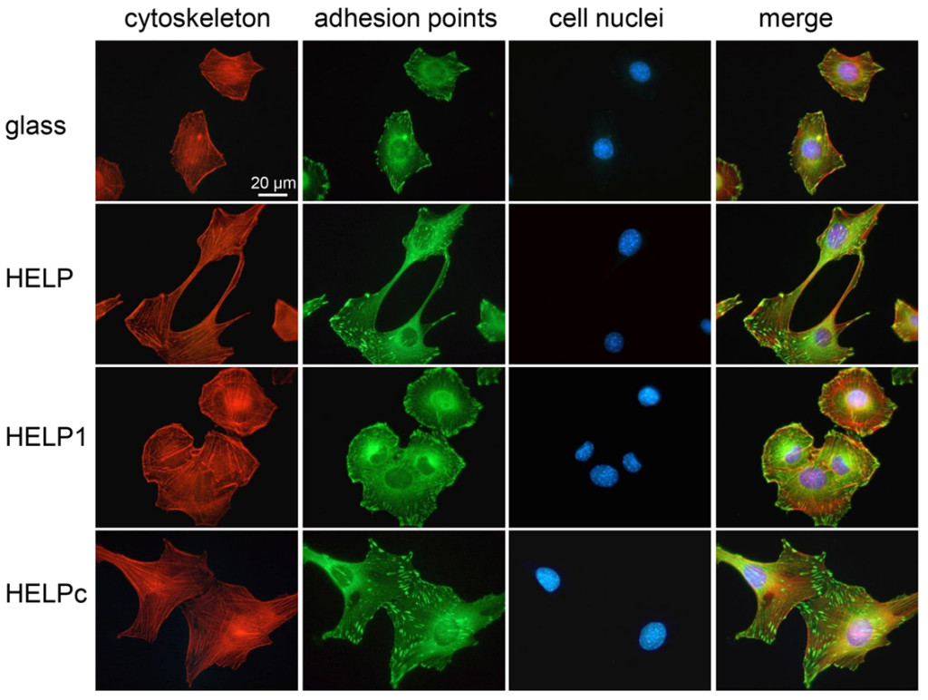 图1细胞在三种help上的粘附诱导了细胞形态、细胞骨架组织(红色)、粘附点的大小和定位(绿色)的显著差异。