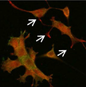 Microscopy image of neurons forming projections called neurites. White arrows indicate the accumulation of proteins called APC, which are required this process. Credit: NICHD/NIH
