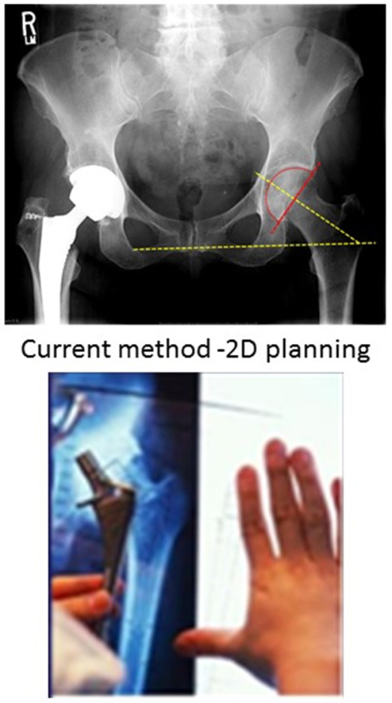 Fig. 1. Initial Planning stages performed on x-rays radiographs