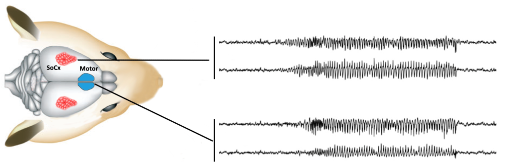 Fig. 2. EEG recording of a spike-and-wave discharge in GAERS in different brain areas (SoCx first two traces) and Motor cortex (last two traces). A delay of 1-2 sec occurred between SoCx and the other structures, suggesting a leading role of SoCx in the initiation of spike-and-wave discharges.
