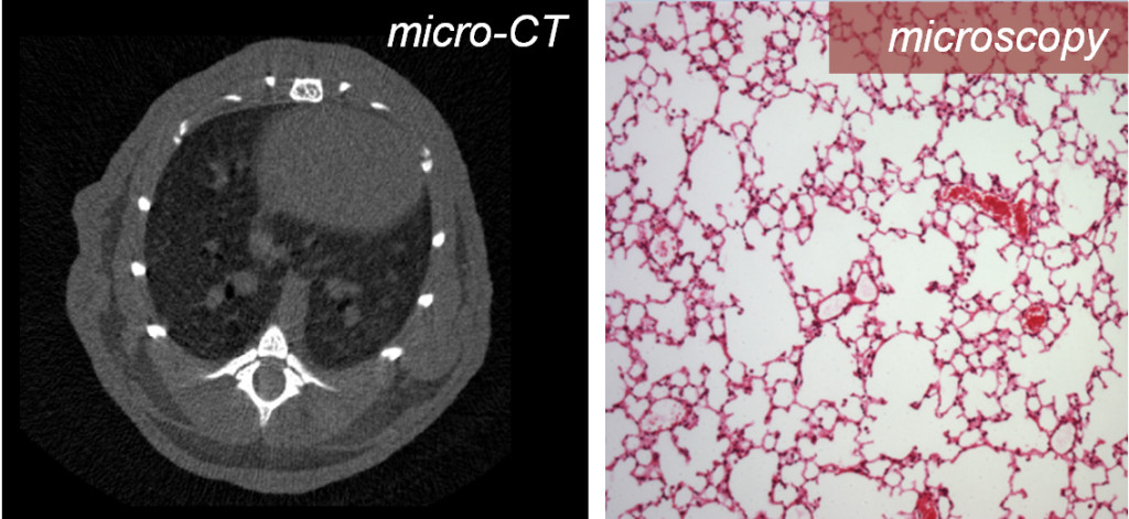 图1所示。小鼠肺的纵向体内微计算机断层扫描:没有放射毒性的证据。
