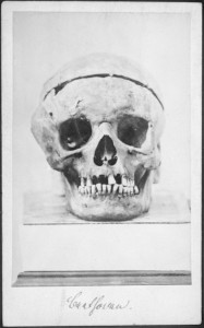 图1所示。贝多芬头骨照片(1863年获得奥地利国家图书馆许可)。