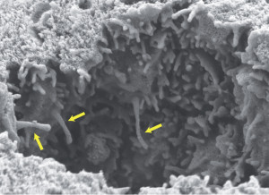 Fig. 1. Primary cilia, indicated by yellow arrows, protruding into the airways of an embryonic mouse lung. Image courtesy of Christian Gojak, Tucker laboratory.