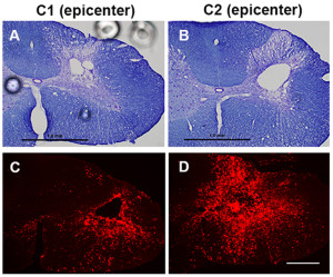 图2所示。脊髓震荡不会改变组织结构(A, B)，但会诱导炎症细胞内流(C, D)。A和B图显示单次和多次震荡后脊髓结构的微小变化。图C和D显示炎症细胞在损伤中心积聚，重复脑震荡大鼠(C2)的炎症细胞比单次脑震荡大鼠(C1)多。数据改编自Jin et al.， 2015, Exp Neurol 271:175-188。