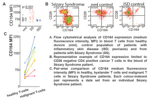 图2所示。ssamzary综合征患者的T细胞中CD164分子的数量增加。