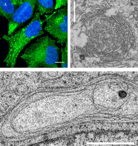 Fig. 1. TMEM170A is an ER sheet-promoting protein. Its silencing causes proliferation of tubular ER (upper panels; left: RTN4 immunofluorescence, right: Transmission Electron Microscopy, TEM, showing increased ER tubules) and its overexpression causes the formation of extensive ER sheet stacks (lower panel; TEM). Scale bars: 10μm (A); 1μm (B); 2 μm (C). Section thickness in B, C is 60nm.