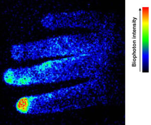 图1所示。一个人右手的生物光子图像的例子。手指上明亮的区域显示了吸烟的影响。图片中的颜色是代表生物光子发射强度的伪颜色。