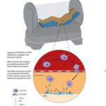 A Stem Cell’s Journey Home