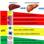 Immunological changes associated with Hepatocellular Carcinoma development