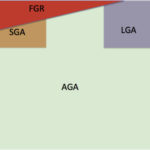 FGR和SGA之间以及AGA和LGA之间可能存在的重叠