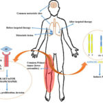 Molecular Targeted Therapy in Alveolar Soft Part Sarcoma