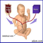 青霉胺与新生儿神经保护
