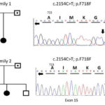 The power of urine to understand genetic variants in the kidney. AoS