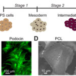 Building an Artificial Kidney from Human Stem Cells. AoS