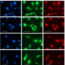 测量内的pH值lysosomes