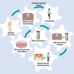 AoS. The Roles of Mesenchymal Stem Cells Secretome in Diabetic Wound Healing.