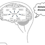 《超能。是否合适of scopolamine as an Alzheimer’s model