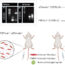 In vivo 2-color multiphoton imaging of genetic reporter fibroblasts in the skin