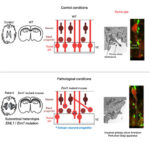 AoS. EML1: an entry point to study cellular mechanisms at the origin of brain malformations.