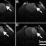 AoS. Cerebral venous hemodynamic in a rat model of acute epidural hematoma