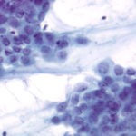 Mucin-secreting vacuolated cells, intermediate cells, and squamous cells