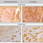 How to stain E-selectin ligands in tumor tissue
