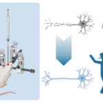 AoS. Intracranial injections and animal models: towards understanding and treating human disease